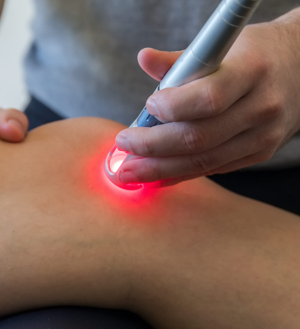 Cold laser 3B therapy